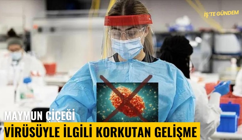 Maymun çiçeği virüsüyle ilgili korkutan gelişme: Daha bulaşıcı varyantı Avrupa'da görüldü