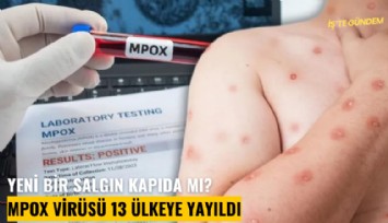 Yeni bir salgın kapıda mı? Mpox virüsü 13 ülkeye yayıldı