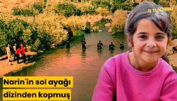 Narin'in sol ayağı dizinden kopmuş